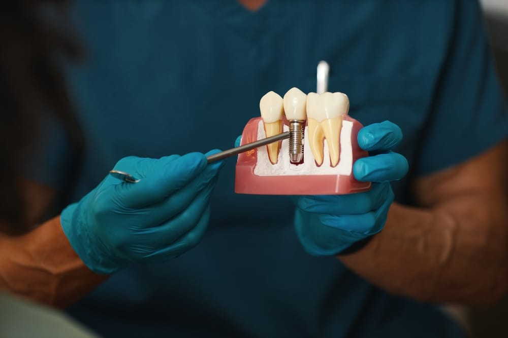 Learn how dental implants work to restore missing teeth with a secure, natural-looking solution. Start your smile transformation - Dental Implants in Lansing, MI.
