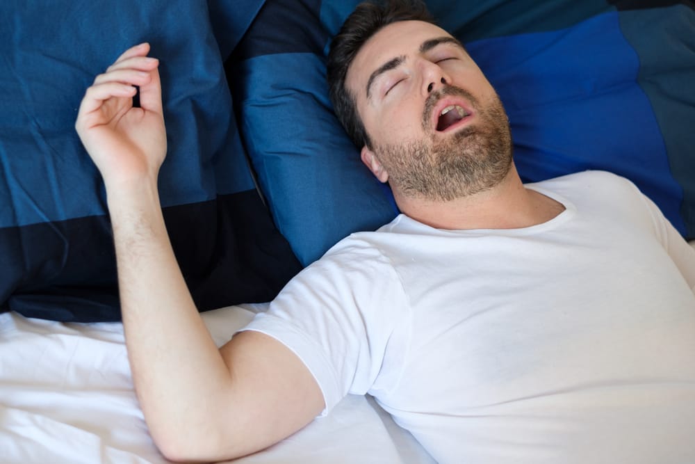 Man sleeping on his back with mouth open, depicting common signs of snoring and possible sleep apnea. - Sleep Apnea 
