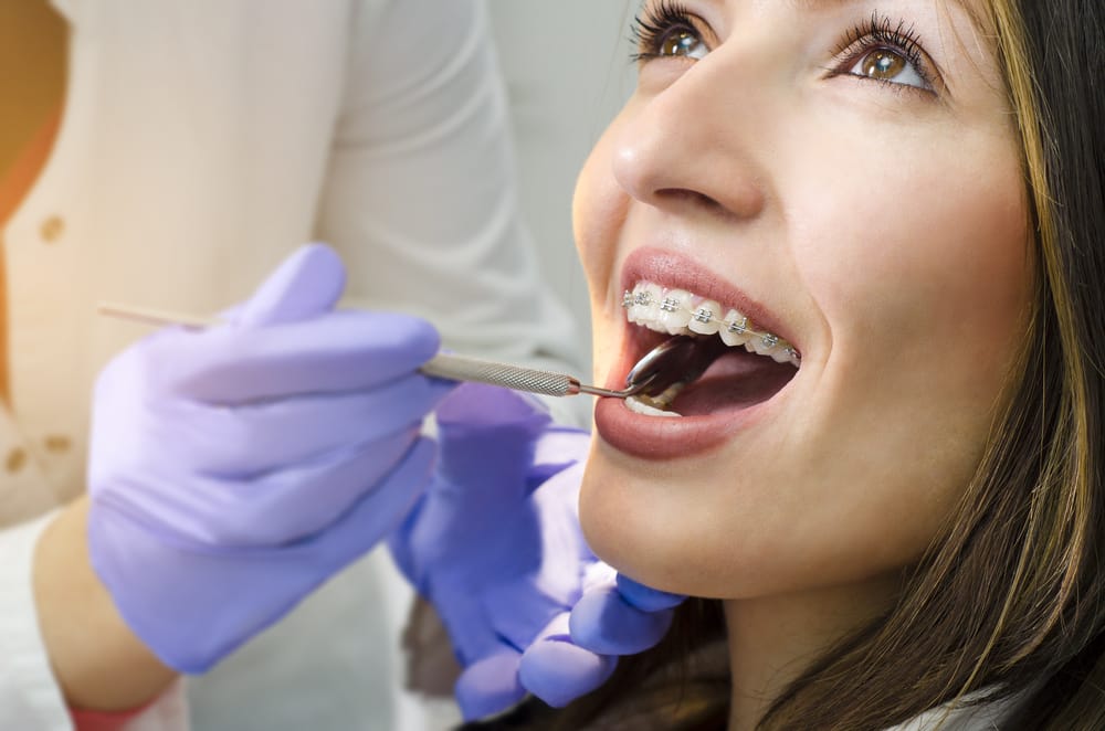 Expert Dental Care for Adults with Braces - Adult Braces in DeWitt, MI Get professional orthodontic treatment and regular check-ups for your adult braces. Achieve the smile you’ve always wanted - Adult Braces in DeWitt, MI.