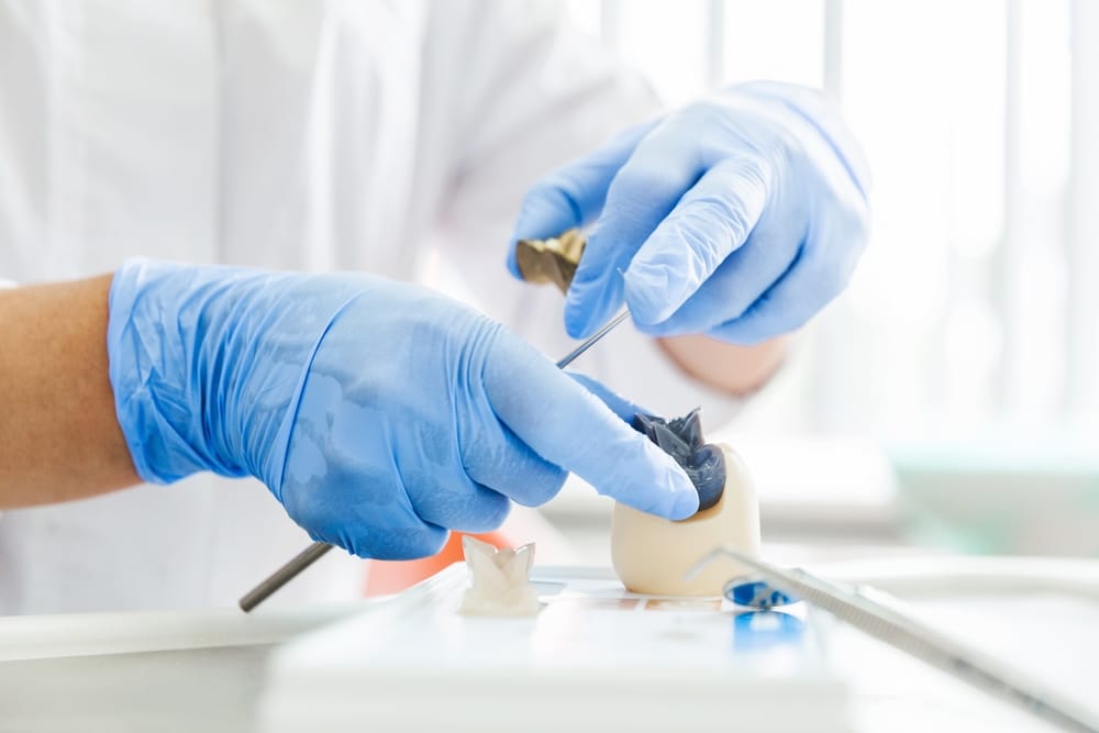 Close-up of a dental technician shaping a tooth model for precise dental restoration and treatment planning - Sealants