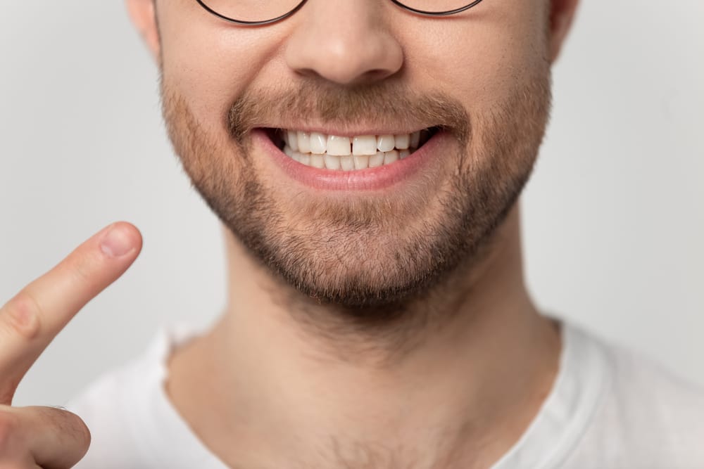 Close-up of a man smiling confidently while pointing to his bright, straight teeth, showing off his healthy smile after dental implant treatment - Dental Implants.